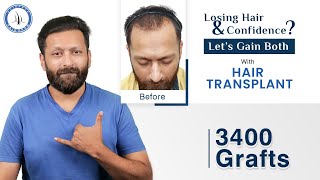 Satisfied Hair Transplant Patient  Hair Transplant Clinic In Gujarat  Hair Transplant Clinic [upl. by Llerej751]