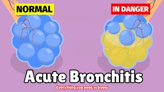 What is Acute Bronchitis  Causes Symptoms Diagnosis amp Treatment [upl. by Descombes97]