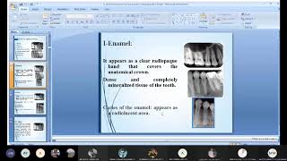 radiographic anatomical landmarks [upl. by Tongue]