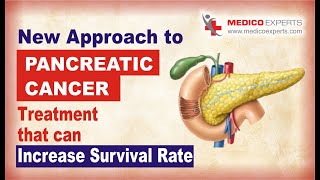 New Approach Towards Pancreatic Cancer Treatment [upl. by Assillem617]