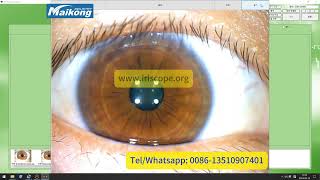 How to user install and uninstall maikong iridology software Korean 2024 [upl. by Yarled467]