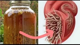 Cure All Infections And Kill All Parasites With This DIY Antibiotic [upl. by Otilia]