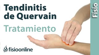 Tendinitis de De Quervain  Tratamiento con ejercicios automasajes y estiramientos [upl. by Neff500]