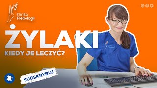 Żylaki  kiedy je leczyć [upl. by Ernaline]