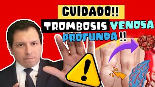 CUIDADO ⚠️ TROMBOSIS VENOSA PROFUNDA  SÍNTOMAS Y COMPLICACIONES 😱😱😱 [upl. by Templas]