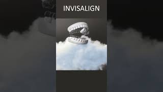 Invisalign Underbite  Time Lapse  London UK [upl. by Stochmal]