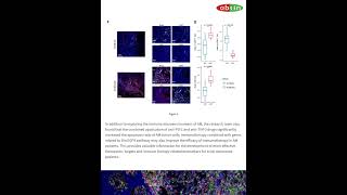 Exploring the Tumor Immune Microenvironment of Melanoma biology mihc [upl. by Doley189]