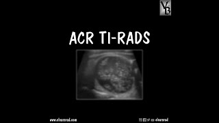 ACR TIRADS [upl. by Lauree]