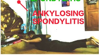 Exercises For ANKYLOSING SPONDYLITIS  ankylosingspondylitis exercise RehabWithArijit painrelief [upl. by Bastien]