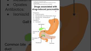 Drugs associated with druginduced pancreatitis [upl. by Carmena]