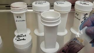 Microbiology Trichrome Staining Procedure [upl. by Naraj]