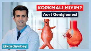 Aort Genişlemesi ve Aort Anevrizması Riskleri ve Tedavileri [upl. by Na836]