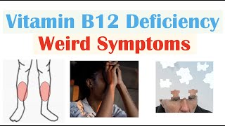 Vitamin B12 Deficiency Weird Symptoms amp Why They Occur [upl. by Lexy]