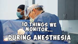 99 of patients dont know what we monitor during surgery [upl. by Joh842]