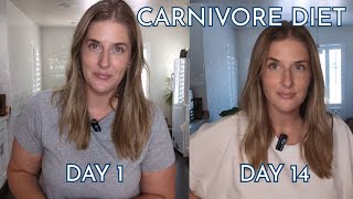 What I Eat for Weight Loss on a Carnivore Diet [upl. by Hadwyn661]