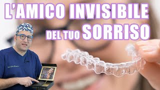 Apparecchio invisibile Invisalign il cofanetto [upl. by Annairba]