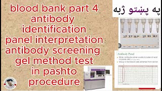 antibody identification panel  antibody screening gel method  blood bank part 4  in pashto [upl. by Goldarina723]