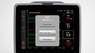 Acumen HPI software SetUp [upl. by Aneloaup308]