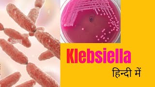 Klebsiella morphology pathogenesis lab diagnosis amp treatment in hindi [upl. by Prudie]