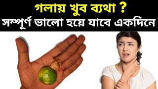 গলায় ব্যথা হলে কি করা উচিতgola betha hole ki korboHome Remedies for Sore Throatpts [upl. by Narad254]