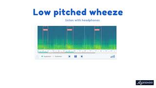 Lung sounds  low pitched wheeze [upl. by Gregoor]