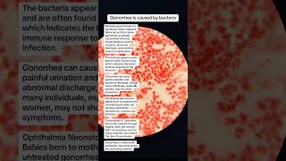 Neisseria gonorrhoeae is bacteria for gonorrhea sexually transmitted infection microbiology [upl. by Nnayllek]