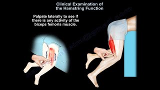 Clinical Evaluation of the Hamstring Muscles  Everything You Need To Know  Dr Nabil Ebraheim [upl. by Wallas524]