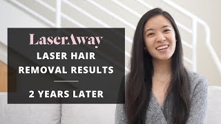 2 YEAR POSTLASER TREATMENT RESULTS  LASERAWAY LASER HAIR REMOVAL EXPERIENCE PART 2 [upl. by Kendre]