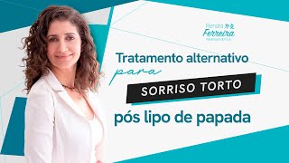 Tratamento alternativo para sorriso torto pós lipo de papada [upl. by Lilith]