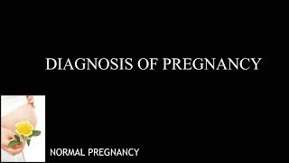 Diagnosis of pregnancy  Probable Presumptive and Positive Signs of Pregnancy [upl. by Boorman]