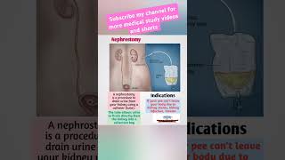 NephrostomyFreeMedicalEducationld3sfnursingmedicalviralviralshortsvideoyoutubeviralshorts [upl. by Liscomb410]