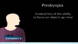 Presbyopia  Gradual Loss of Sight [upl. by Ellennahc88]