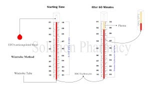 ESR Test  Erythrocyte Sedimentation Rate  ESR Determination  Erythrocyte Sedimentation Test [upl. by Crandall237]