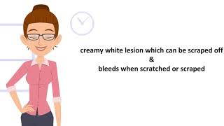 know oral candidiasis  oral thrush in just 2 mins [upl. by Hilaria]