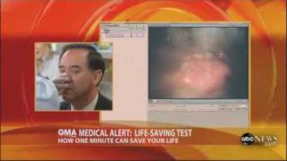 TNE5000 Esophagoscope featured on GMA [upl. by Attenyt439]