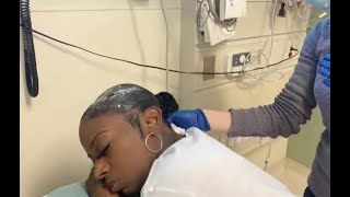 Woman who put Gorilla Glue in her hair gets free surgery [upl. by Madid]