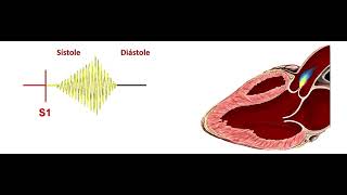 Soplo estenosis aortica [upl. by Ramedlaw]