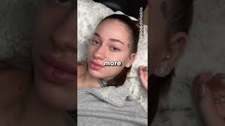 Bhad Bhabie Has Cancer [upl. by Odawa]