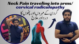 Pinched nerve in neck  C4C5C6 Cervical Radiculopathy  physical therapy treatment [upl. by Reinwald613]