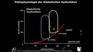 WINFOCUS Webinar  Linksventrikuläre diastolische Dysfunktion in der Intensivmedizin [upl. by Gneh205]