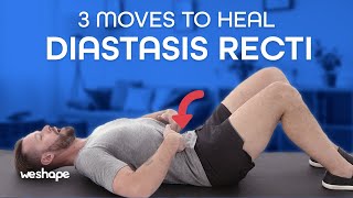 3 Moves To Heal Diastasis Recti [upl. by Notaes731]