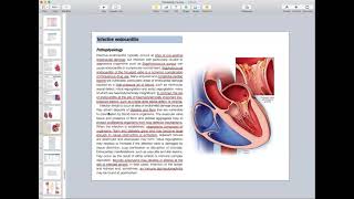 Infective Endocarditis Myocarditis Pericarditis  Cardiology Course [upl. by Enautna]