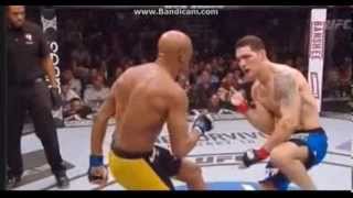 Anderson Silva Broken Leg [upl. by Ahseem308]