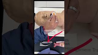 OROPHARYNGEAL AIRWAY INSERTION TECHNIQUE criticalcaremedicine emergencymedicine airwaymanagement [upl. by Latsryk]