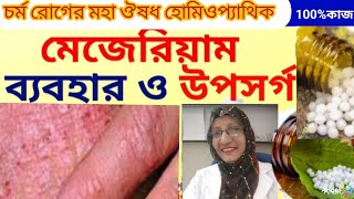 চর্ম রোগের মহাঔষধ মেজেরিয়াম MEZEREUM হোমিওপ্যাথিক মেডিসিন। বিস্তারিত জেনে নিন। [upl. by Sedrul]