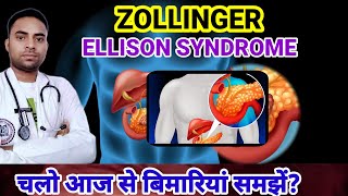 Whats Zollinger Ellison Syndrome ZES DISEASE  SYMPTOMS OF ZES  DISEASES [upl. by Calva]