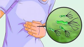 6 Remédios Caseiros para Eliminar a Bactéria H Pylori [upl. by Kovar305]