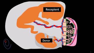 Twin to twin transfusion syndrome TTTS   part 1 pathogenesis [upl. by Yentiw]