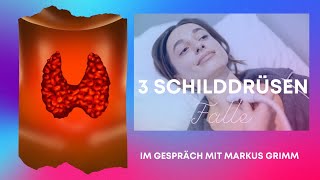 3 Schilddrüsenfälle [upl. by Felicia]