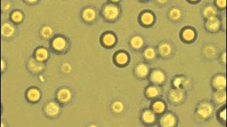 Lysis of erythrocytes in the hypotonic buffer [upl. by Gebhardt]